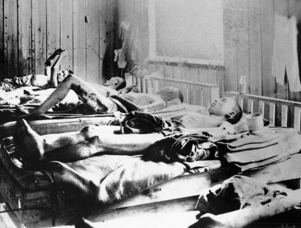 Victims of the atomic blast